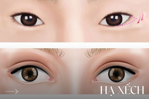 Hạ xếch